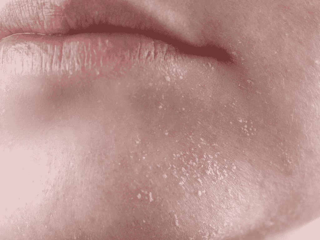 Dry and Dehydrated Skin: Everything You Need to Achieve Hydration